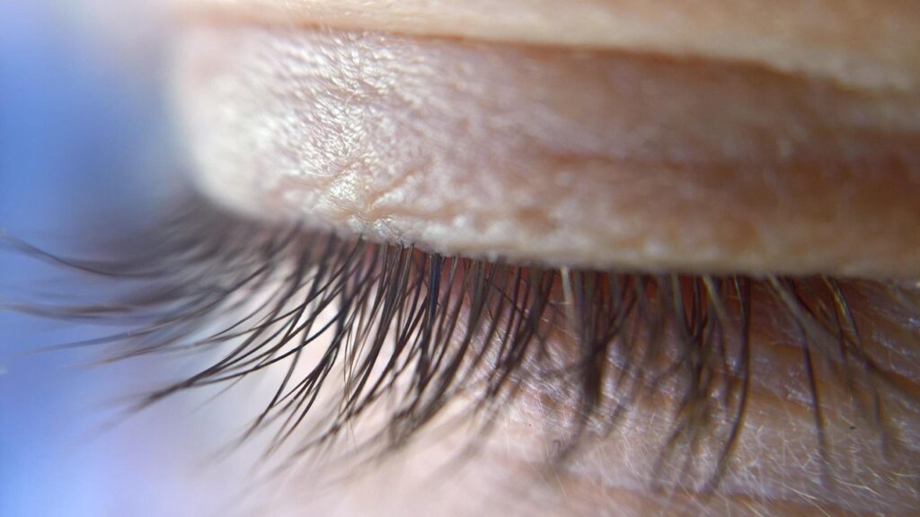 geschlossenes Auge, gesunder sauberer Lidrand & Wimpern